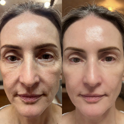 Bálsamo Facial Reafirmante - Elimina Arrugas y Líneas de Expresión – Dr. Melaxin