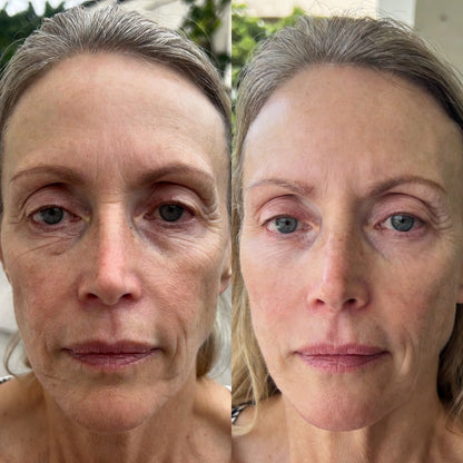 Medicube Bálsamo Antiedad GLOW SKIN – Efecto Lifting, Firmeza y Volumen
