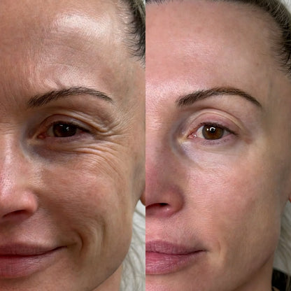 Bálsamo Facial Reafirmante - Elimina Arrugas y Líneas de Expresión – Dr. Melaxin