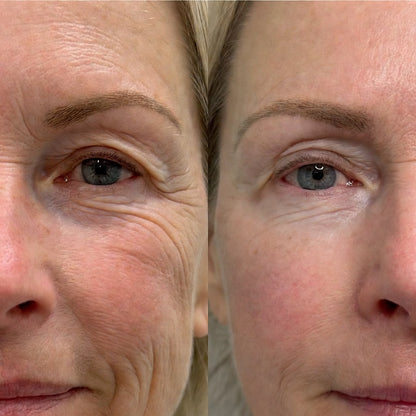 Bálsamo Facial Reafirmante - Elimina Arrugas y Líneas de Expresión – Dr. Melaxin