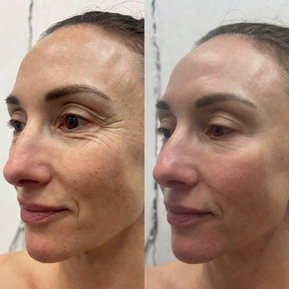 Bálsamo Facial Reafirmante - Elimina Arrugas y Líneas de Expresión – Dr. Melaxin