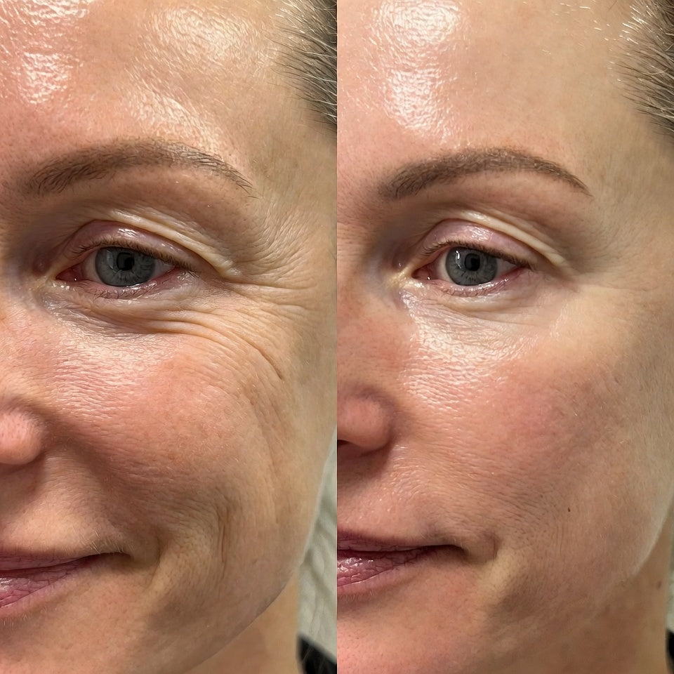 Bálsamo Facial Reafirmante - Elimina Arrugas y Líneas de Expresión – Dr. Melaxin