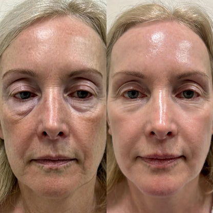 Medicube Bálsamo Antiedad GLOW SKIN – Efecto Lifting, Firmeza y Volumen